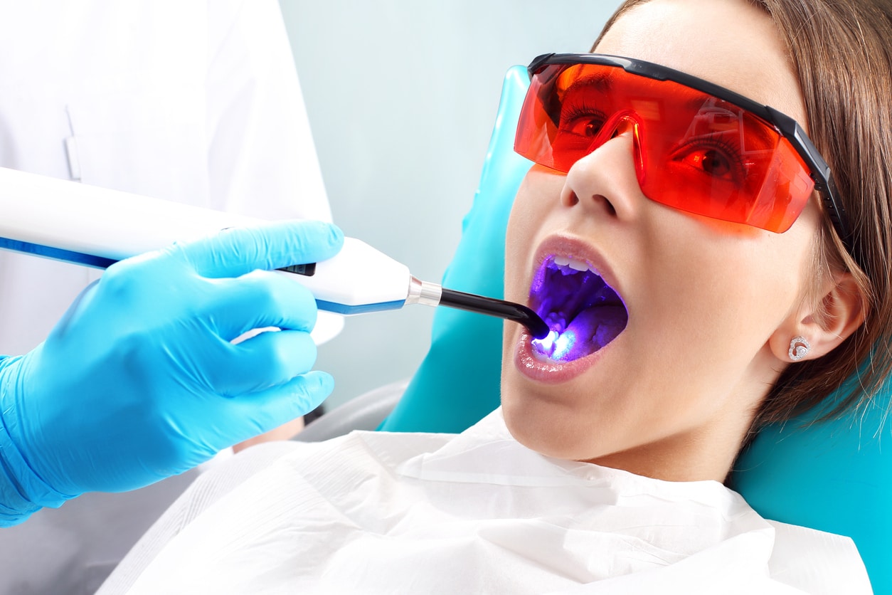 Root Canal